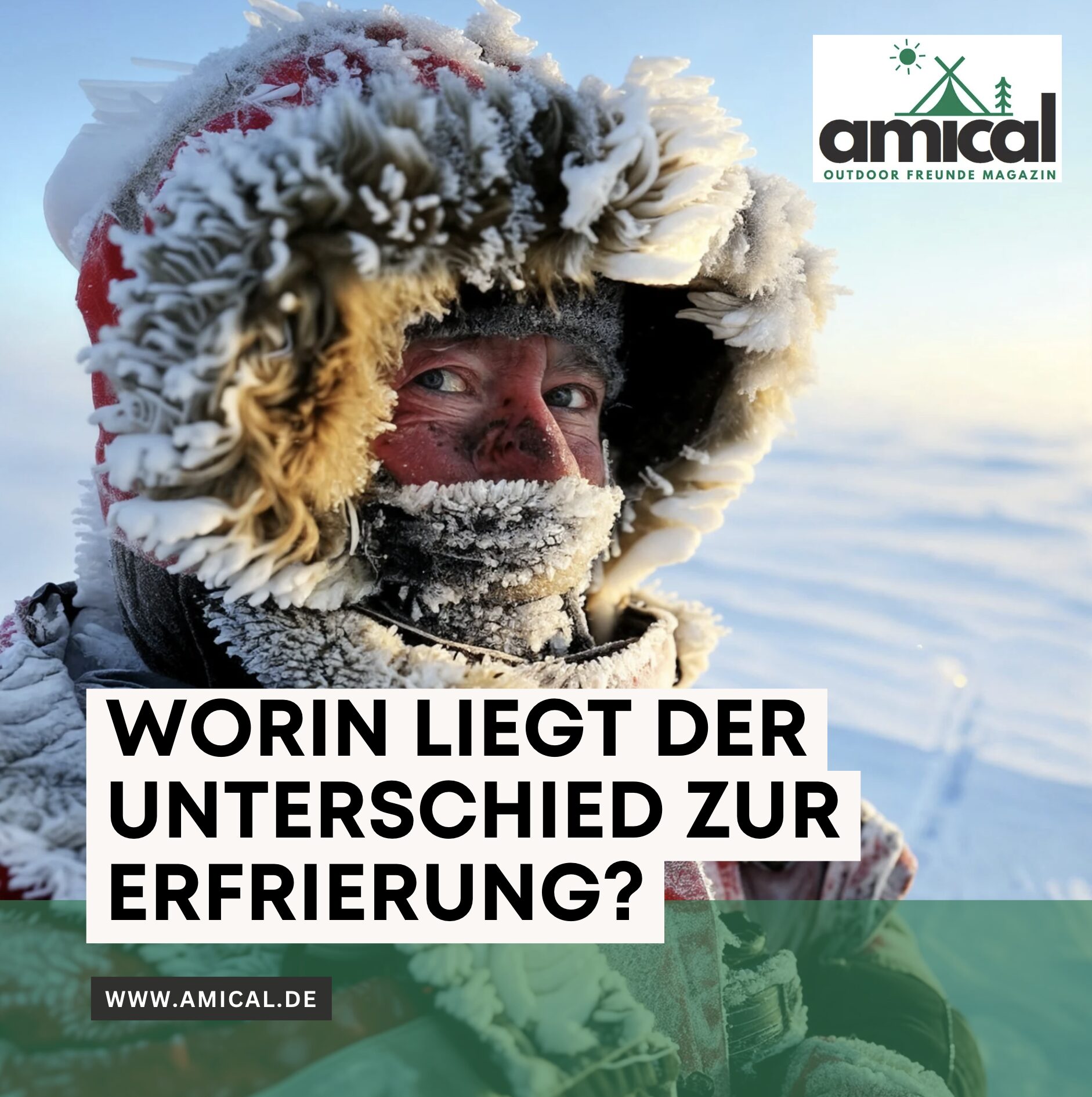  Worin liegt der Unterschied zur Erfrierung?